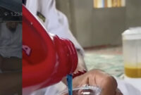 Bahaya Fenomena Minum Oli Memicu Peringatan Medis Serius bagi Masyarakat